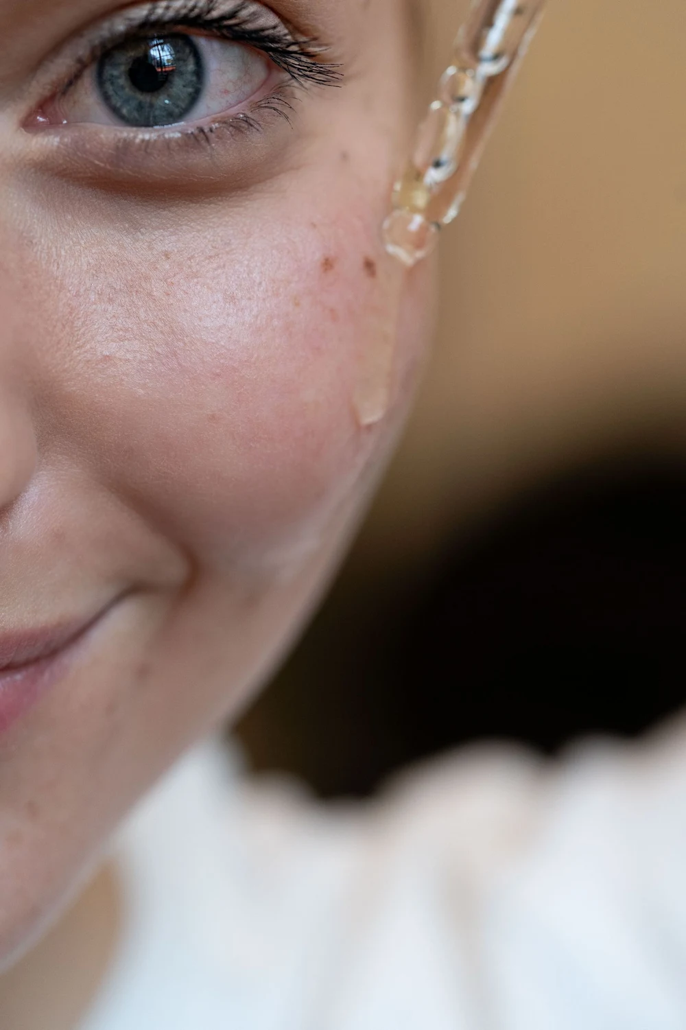 Anti-acne chemical peel for breakouts and acne marks