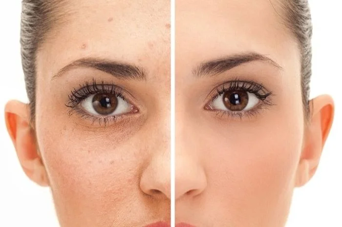 Pigmentation & Dark Spots
